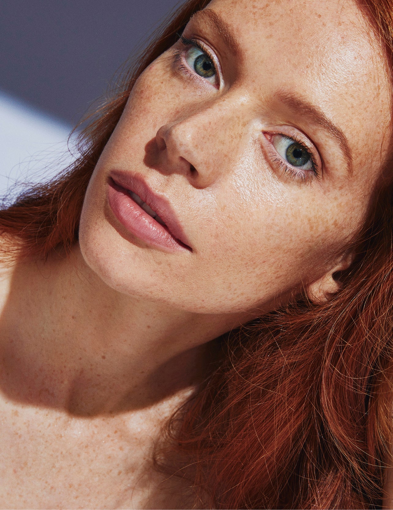 Leiden Sie unter Hyperpigmentierung? So verblassen dunkle Flecken nach einem Ausbruch